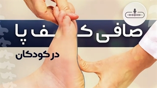 صافی کف پا در کودکان