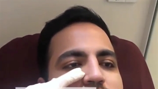 مزوتراپی زیر چشم