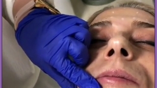 مزوژل چیست؟ با کاربردها و مزایای آن آشنا شوید