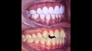 ارتودنسی اصلاح طرح لبخند | دکتر داودیان