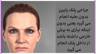 عوارض جراحی پلک