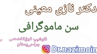 سن ماموگرافی