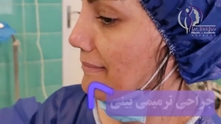 جراحی ترمیمی بینی