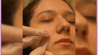 هزینه و مزایای شگفت انگیز کربوکسی تراپی