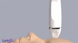 انیمیشن کارکرد میکرونیدلینگ راه طبیعی جوانسازی پوست جوانسازی پوست
