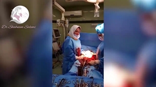 در مورد میوم ها بیشتر بدانید