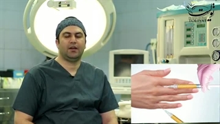 همه چیز در مورد تزریق چربی| دکتر علیرضا تولیت