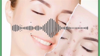 بهترین راهکارهای از بین بردن جای جوش و درمان آکنه اصلاح فرم صورت