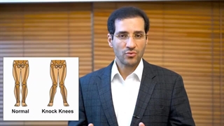 آنچه که باید از زانوی ضربدری بدانید!