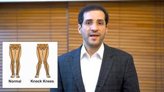 آنچه که باید از زانوی ضربدری بدانید!