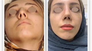 فیلم جراحی بینی نیمه فانتزی