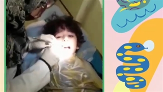 فیلم ترمیم دندان پسر خوشتیپ