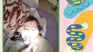 فیلم فلورایدتراپی دندان کودک