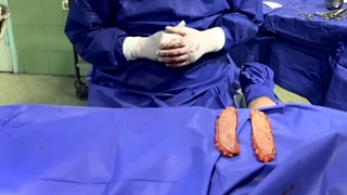 فیلم اتاق عمل براکیوپلاستی