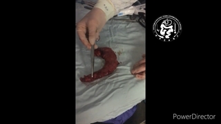 فوندوس معده بیشترین محل ترشح هورمون گرلین