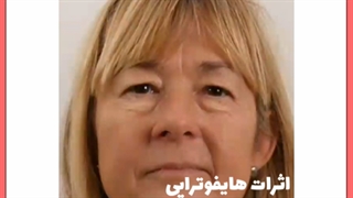 هایفوتراپی معجزه جوانسازی و لیفت صورت / هزینه و مزایا زیبایی پوست