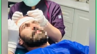 آشنایی با جدیدترین و مدرن ترین روش های کاشت مو در ایران