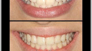 یک درمان زیبا و کوتاه | دکتر احسان ابوئی مهریزی