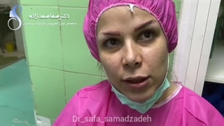 عمل اندوسکوپی سینوس