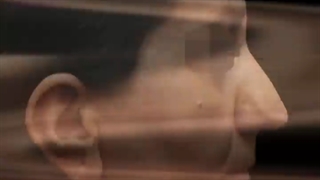 فیلم قبل و بعد از جراحی زیبایی بینی