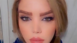 قبل وبعد از جراحی زیبایی بینی
