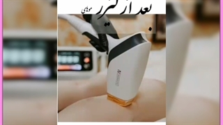 لیزر بیکینی(واژن) هزینه،خطرات، مزایای بی نظیر به همراه عکس