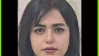 قیمت، مزایا و عوارض احتمالی رینوپلاستی