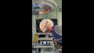 عمل جراحی دکتر رضا اشراقی با دوربین پزشکی Surgical Camera