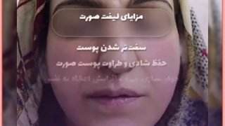 معرفی۱۱روش مدرن و معجزه گر لیفت صورت