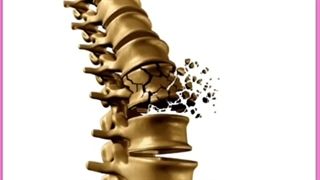 ۷ کمبود رایج ویتامین ها و مواد معدنی و نشانه های مهم هر کدام