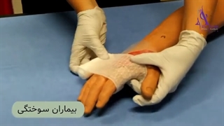فیلم درمان بیماران سوختگى در اتاق عمل