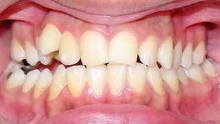 رضایت بیمار عزیز.متخصص ارتودنسی تهران دکترعلیرضا خدیوی