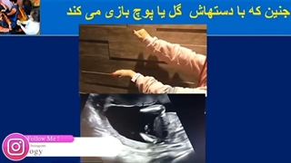 جنینی که با دستاش گل یا پوچ بازی میکنه