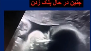 تصویر سه بعدی خیلی کمیاب از جنینی با چشمان باز
