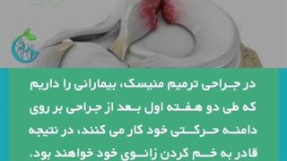 مراقبت های بعد از جراحی منیسک