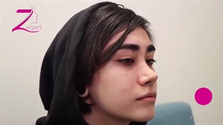 فیلم آموزش ماساژ دادن بینی بعد از جراحی