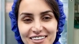 جراحی ترمیمی بینی با پیوند غضروف دنده | دکتر محمدعلی حسینی زیبایی پوست