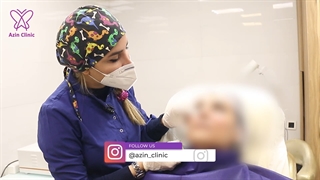 تزریق ژل و فیلر