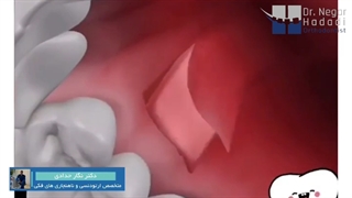 ارتودنسی و جراحی های لثه | دکتر نگار حدادی متخصص ارتودنسی کاشت مو