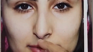 جراحی بینی استخوانی با قوز شدید و افتادگی نوک بینی | دکتر امید ابراهیمی