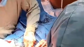 فیلم جراحی تومور ران