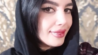 سی و پنج روز بعد از عمل بینی