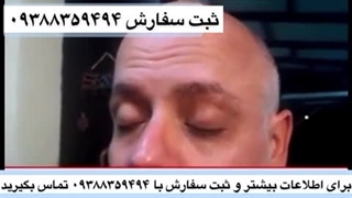 رفع چین و چروک در مدتی مشخص با تاثیرات فوق العاده