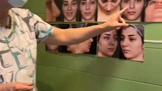 فیلم کامل و بدون سانسور از رینو پلاستی بینی گوشتی