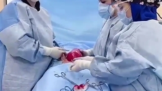 جراحی رحم با فیبروم بزرگ