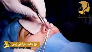 ایا جای بخیه ها بعد از عمل میماند؟| دکتر سعید ظفرمند