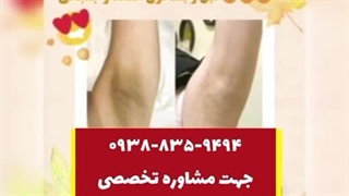 رفع تیرگی و کک و مک و جای جوش