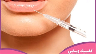 تزریق ژل