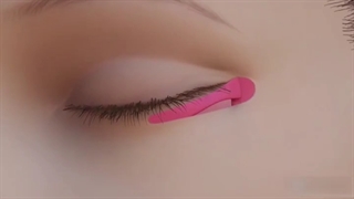 جراحی اکتروپیون