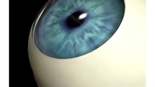 آب سیاه یا گلوکوم